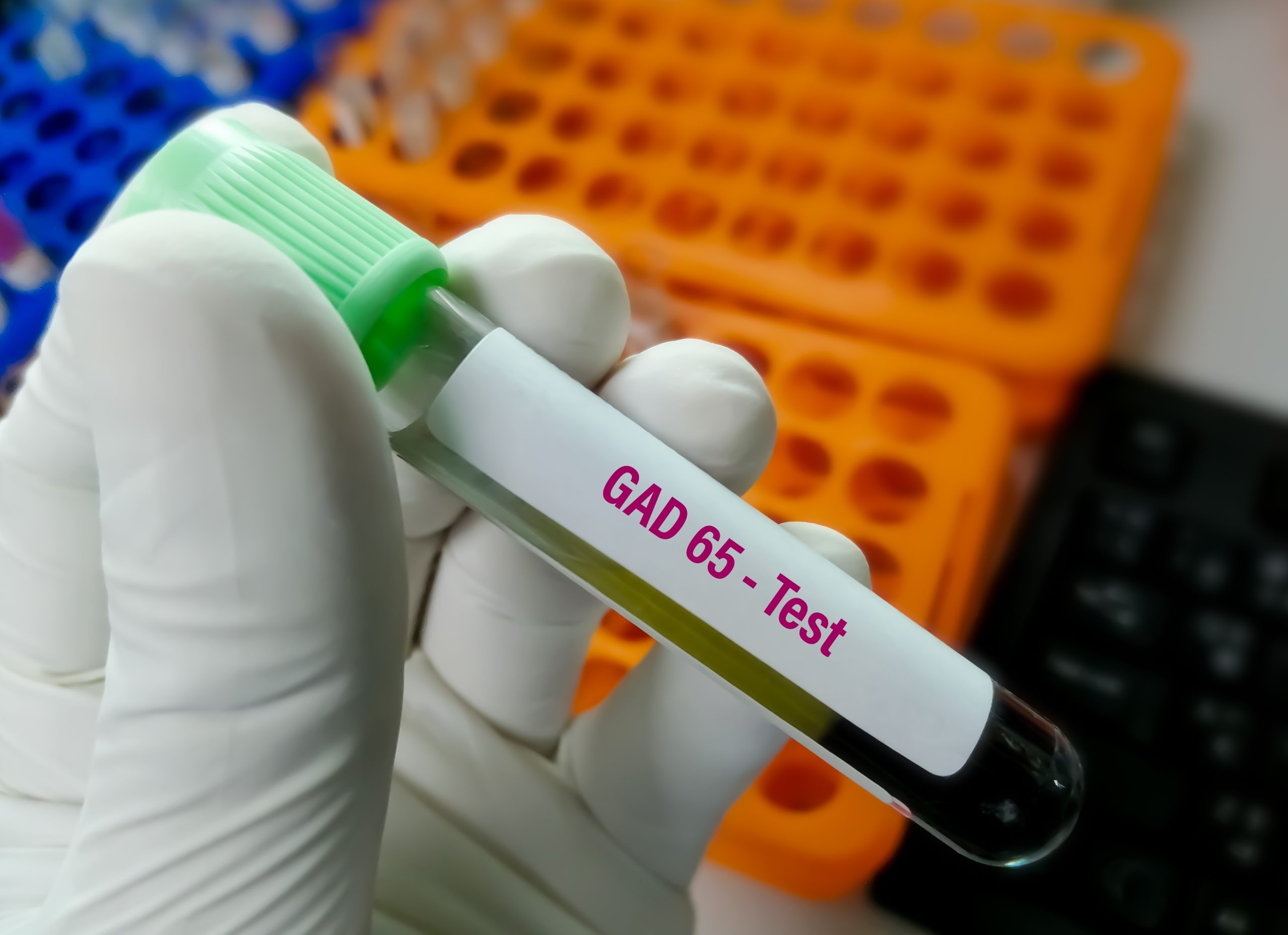 GAD 65 IGG Test In Bangalore