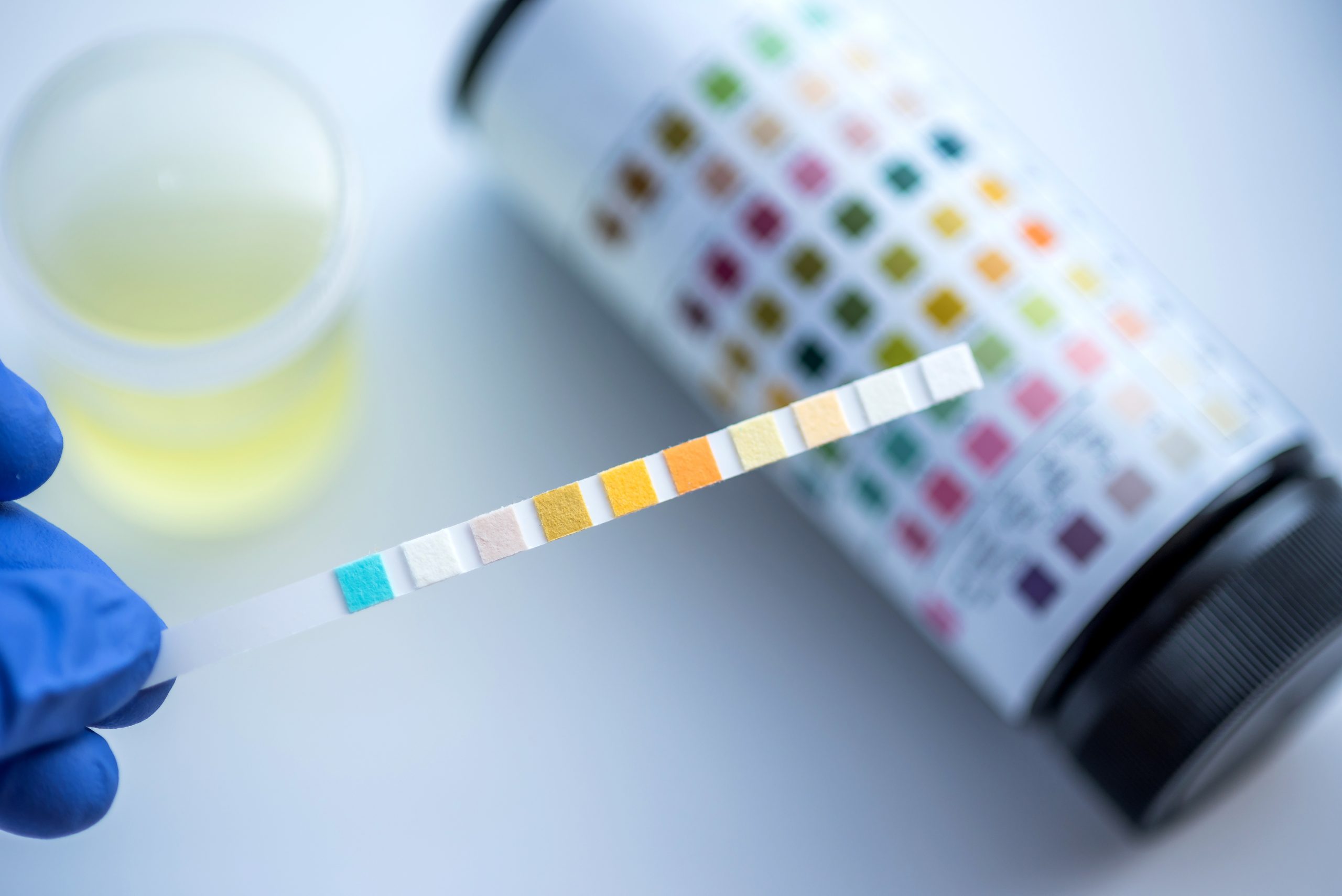 Urine Test (pH) In Noida